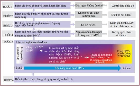 Tiêu chuẩn chẩn đoán bệnh mạch vành: Hướng dẫn chi tiết và chính xác